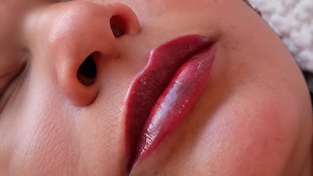 Cuidados antes e depois da micro labial Cuidados antes e depois da micro labial