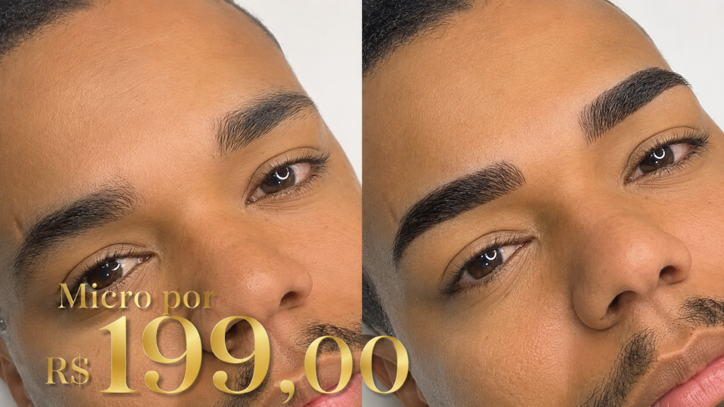 Micropigmentação masculina: Micropoa Micropigmentação masculina: Micropoa