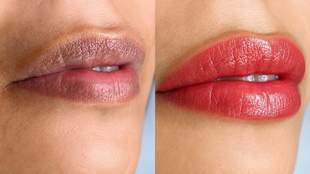 Micro labial por apenas R$ 199,00 micro labial por apenas R$ 199,00 reais em Porto Alegre